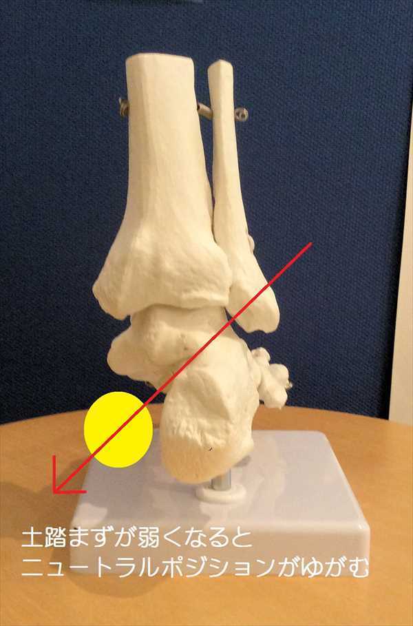 足首のゆがみ